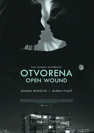 Открытая рана (2016)